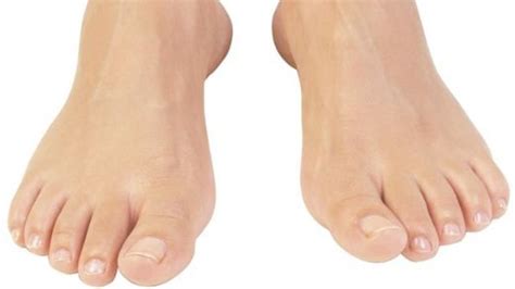 ayak parmaklarının şişmesi ve morarması